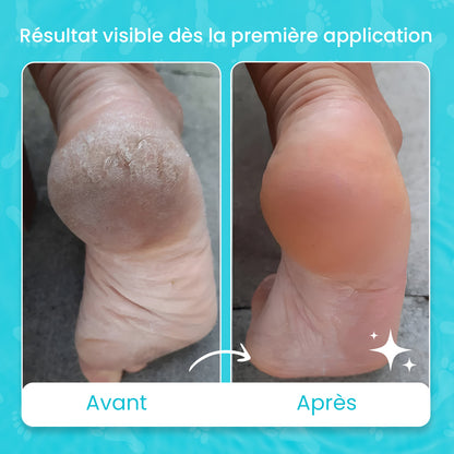 Pack des pieds zurie