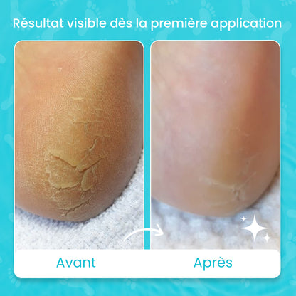 Pack des pieds zurie