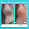 Pack des pieds zurie ar